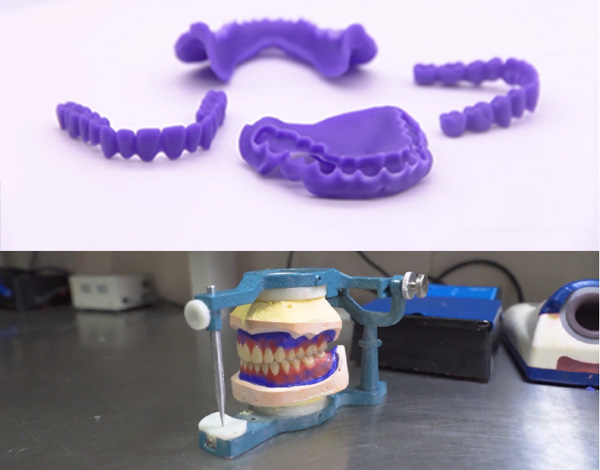 Replacing 3D printed teeth with real false teeth