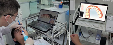 3D scanning oral cavity