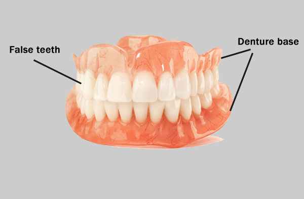 Denture: Denture base + false teeth