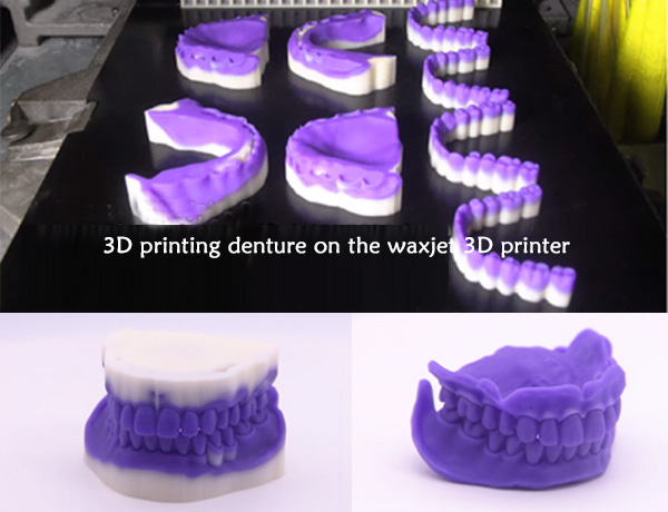 3D printing denture on the waxjet 3D printer