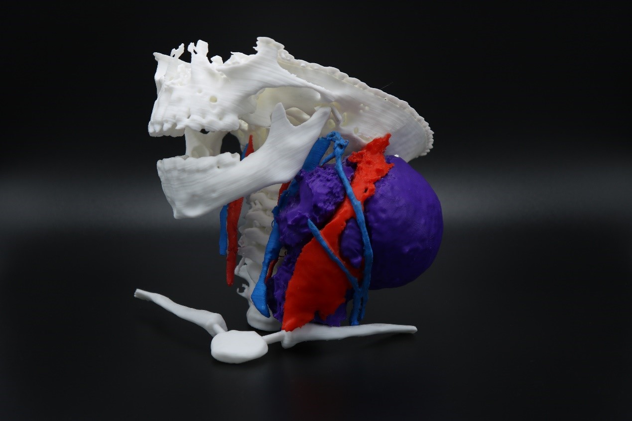 3D printing,professional 3D printer,Flashforge, medical use,customization 