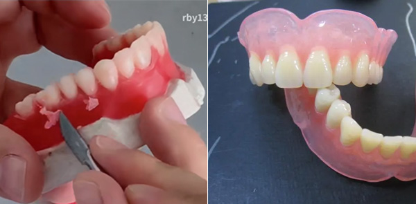 wax denture module and final denture